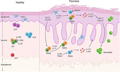 Innate Lymphocytes in Psoriasis